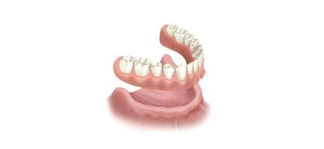 Complete Dentures - Jehovah Dental Centre